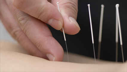 La energía que transcurre por el interior de los canales de acupuntura, Jing Qi 精氣 (energía de canal, Jing Lugo) es una modalidad ingénita del QI 氣 